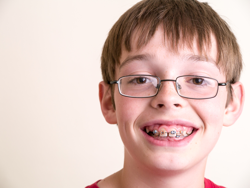What Parents Should Know Before Their Child Gets Braces